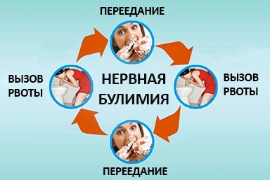 Лечение булимии в Бабаюрте